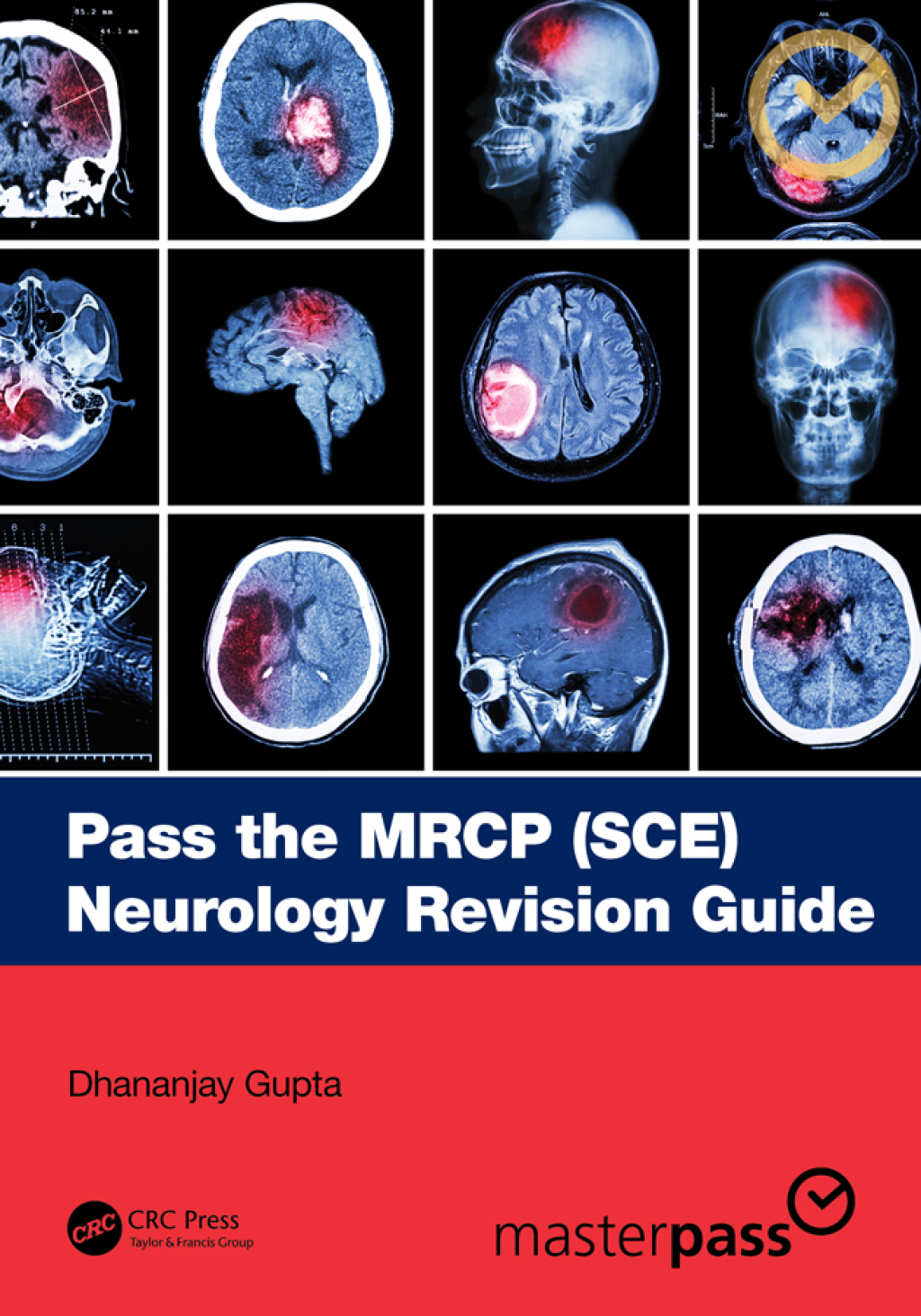 Pass the MRCP (SCE) Neurology Revision Guide 1st Edition