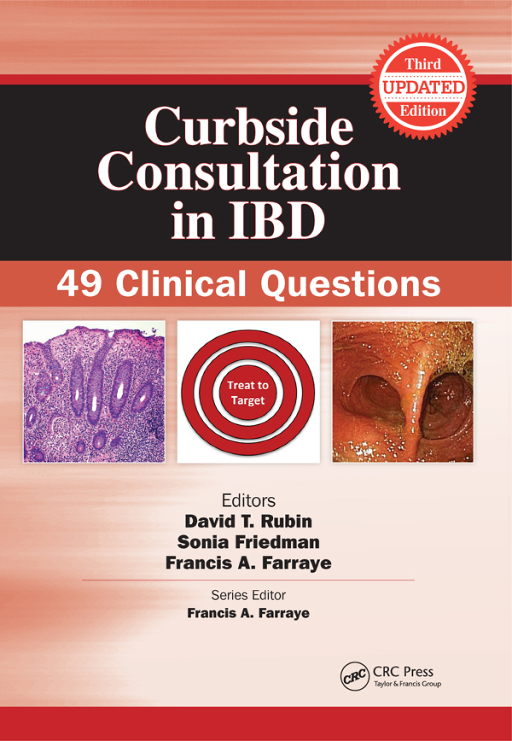 Curbside Consultation in IBD 49 Clinical Questions 3rd Edition