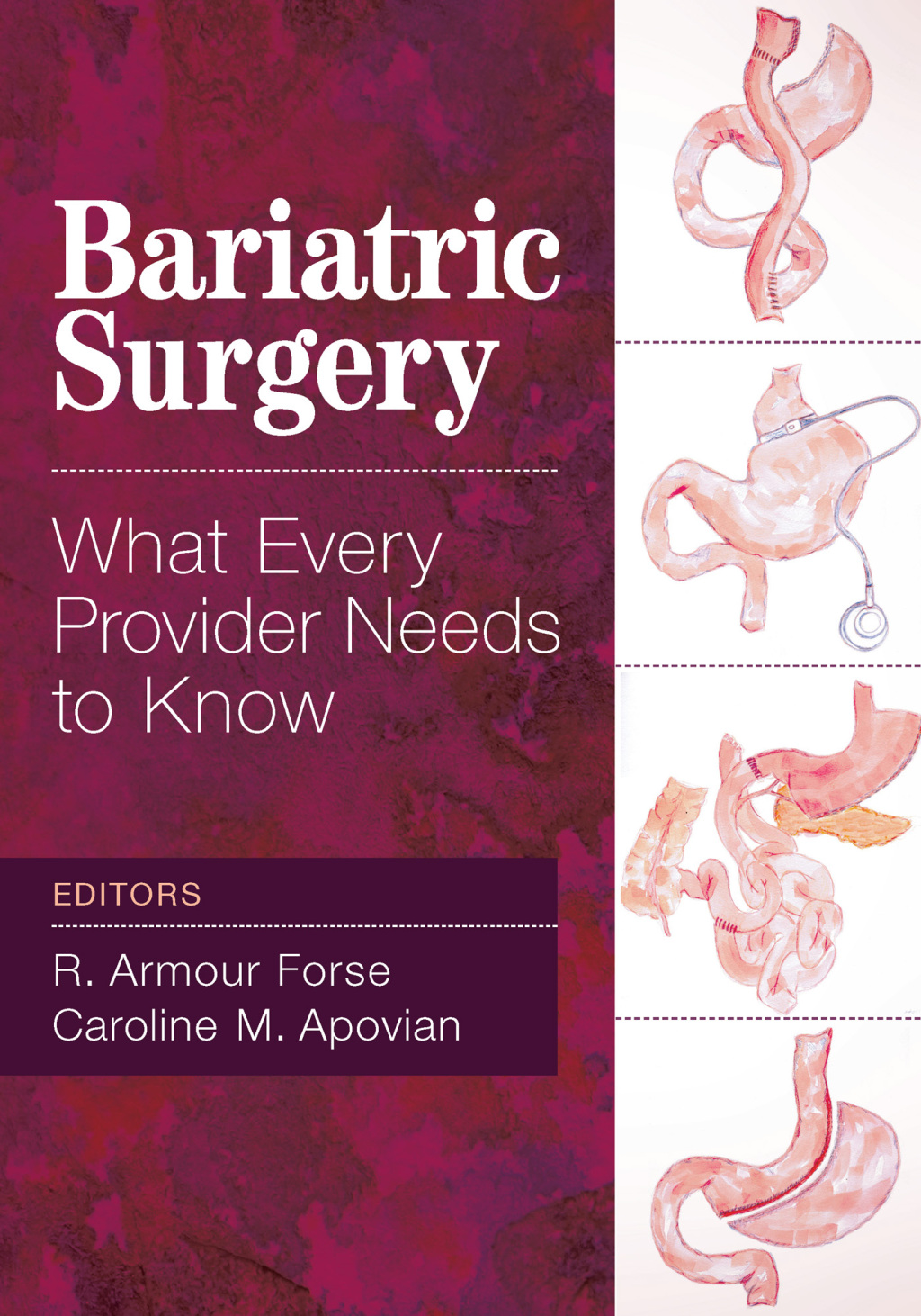 Bariatric Surgery What Every Provider Needs to Know 1st Edition
