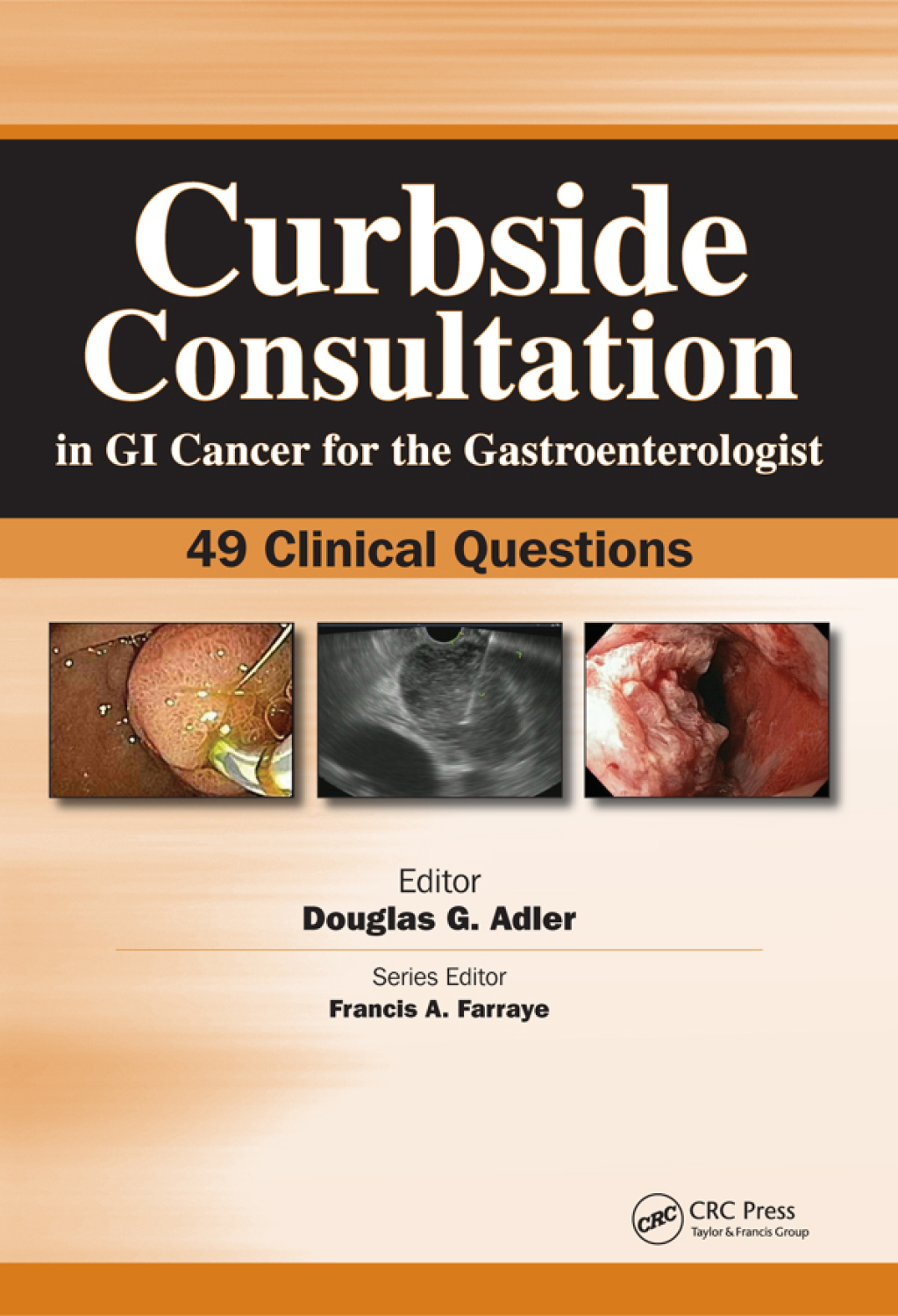 Curbside Consultation in GI Cancer for the Gastroenterologist 49 Clinical Questions 1st Edition