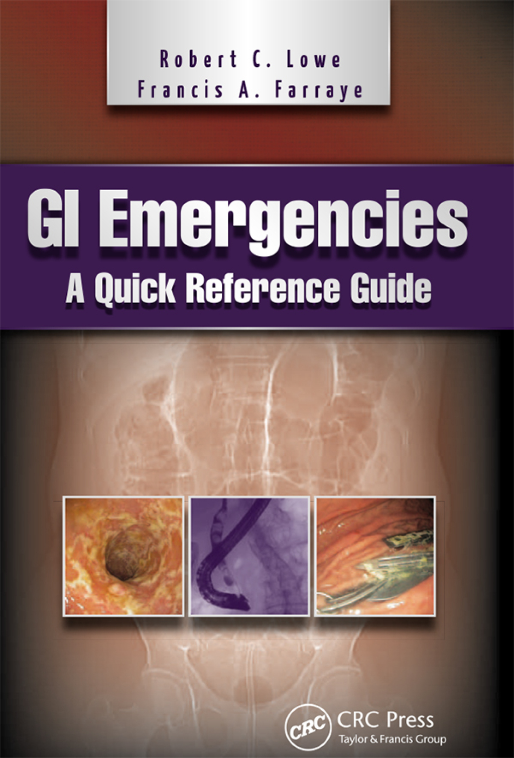 GI Emergencies A Quick Reference Guide 1st Edition