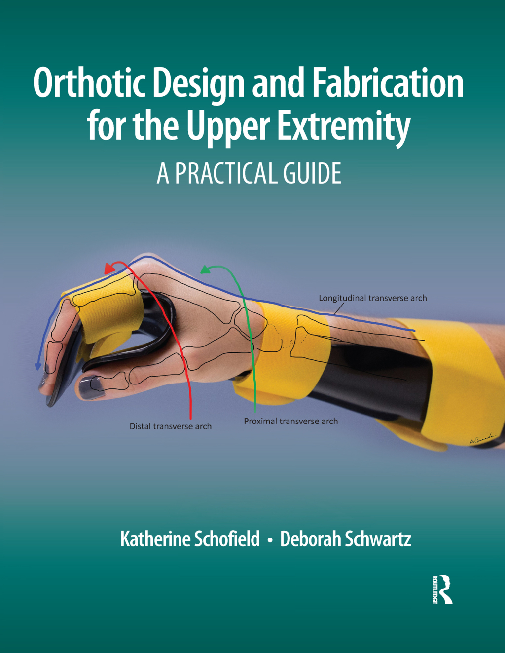 Orthotic Design and Fabrication for the Upper Extremity A Practical Guide 1st Edition