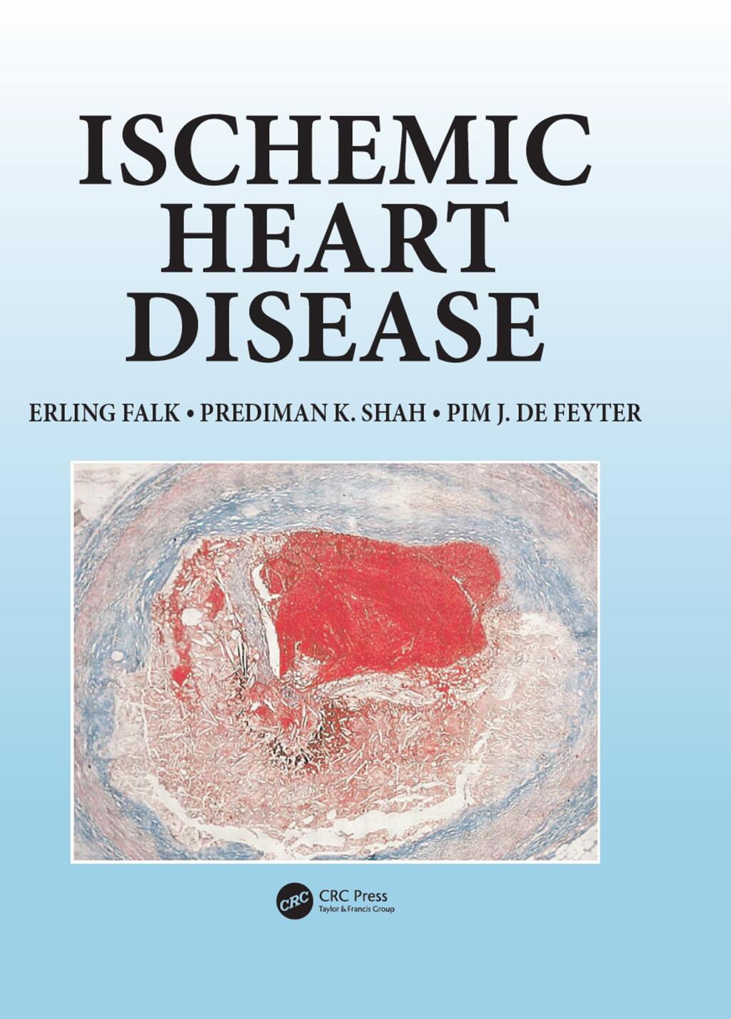 Ischemic Heart Disease 1st Edition