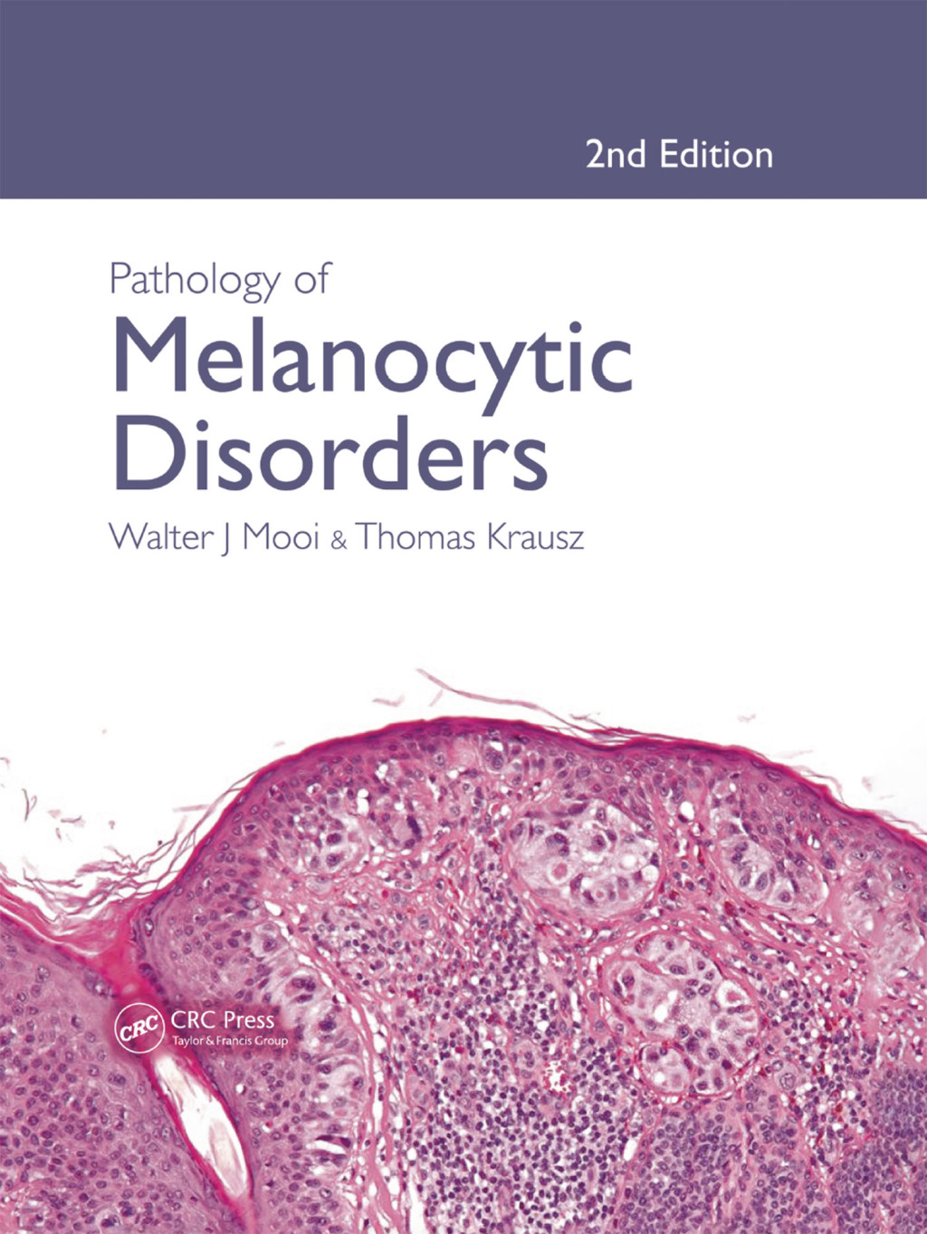 Pathology of Melanocytic Disorders 2ed 2nd Edition