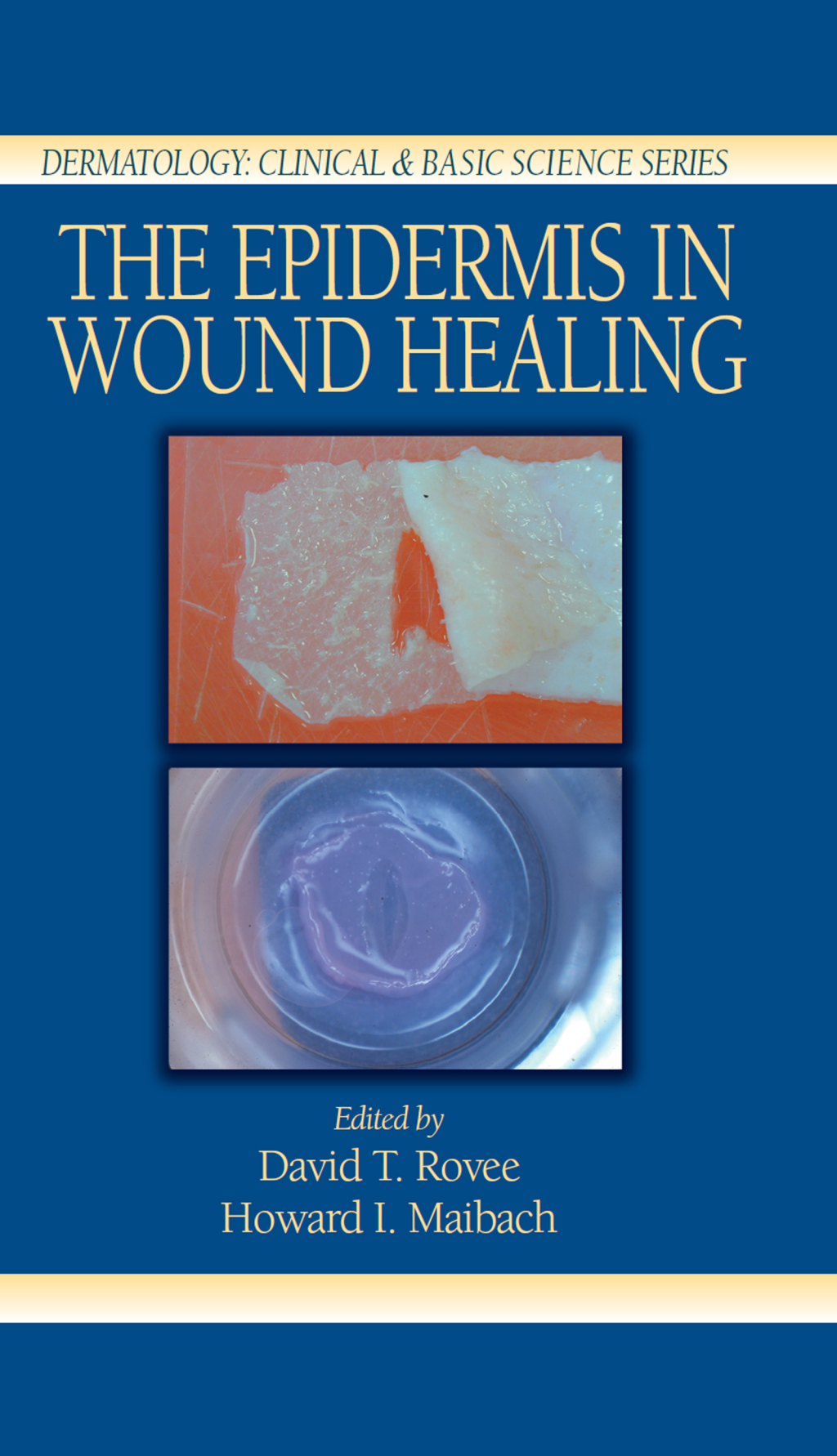 The Epidermis in Wound Healing 1st Edition