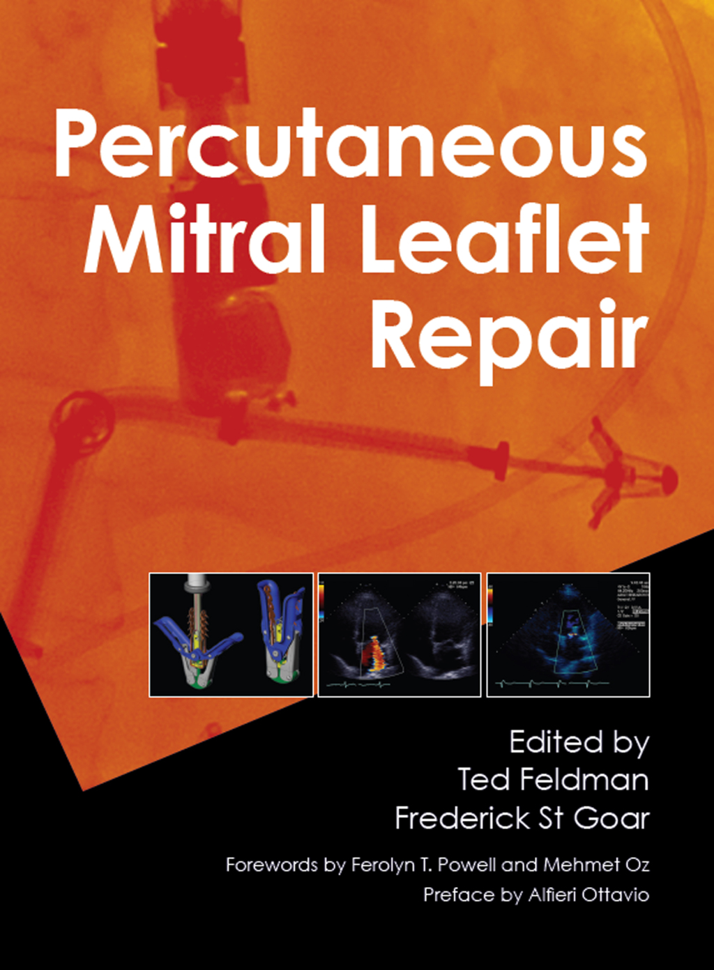 Percutaneous Mitral Leaflet Repair MitraClip Therapy for Mitral Regurgitation 1st Edition
