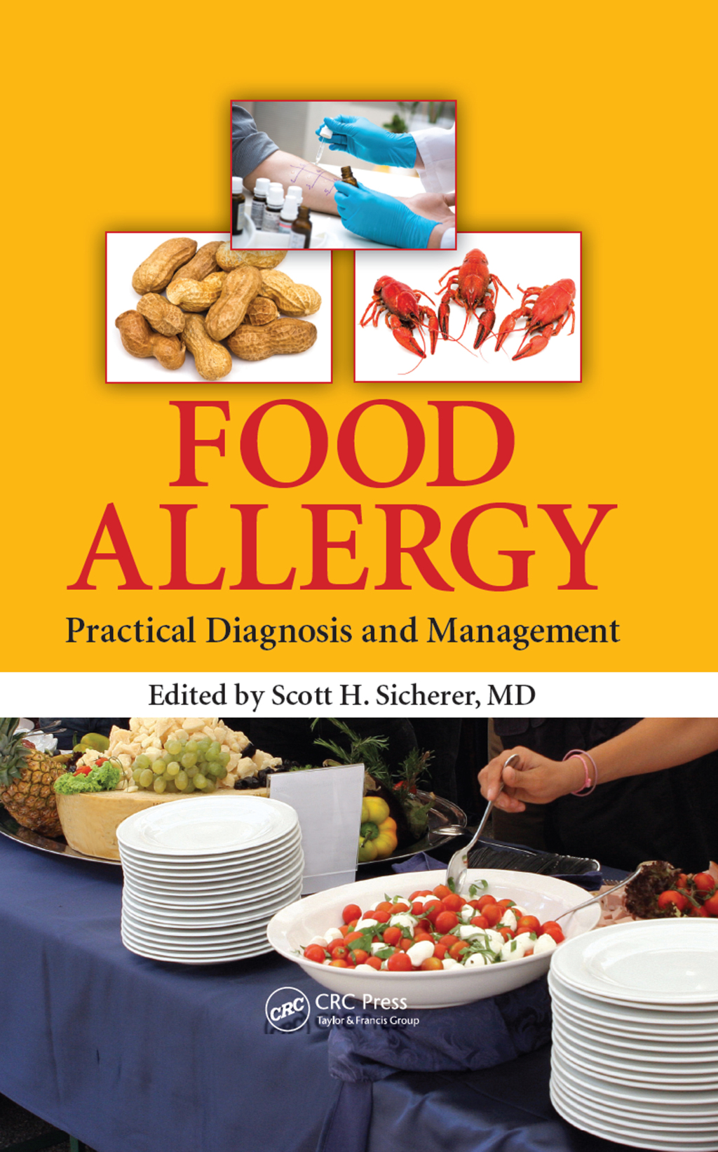 Food Allergy Practical Diagnosis and Management 1st Edition