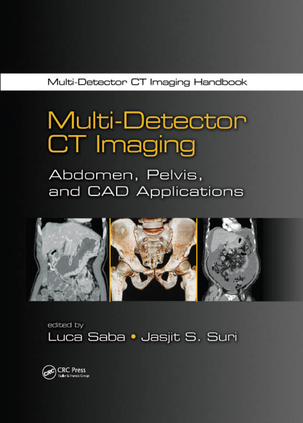 Multi-Detector CT Imaging Abdomen, Pelvis, and CAD Applications 1st Edition