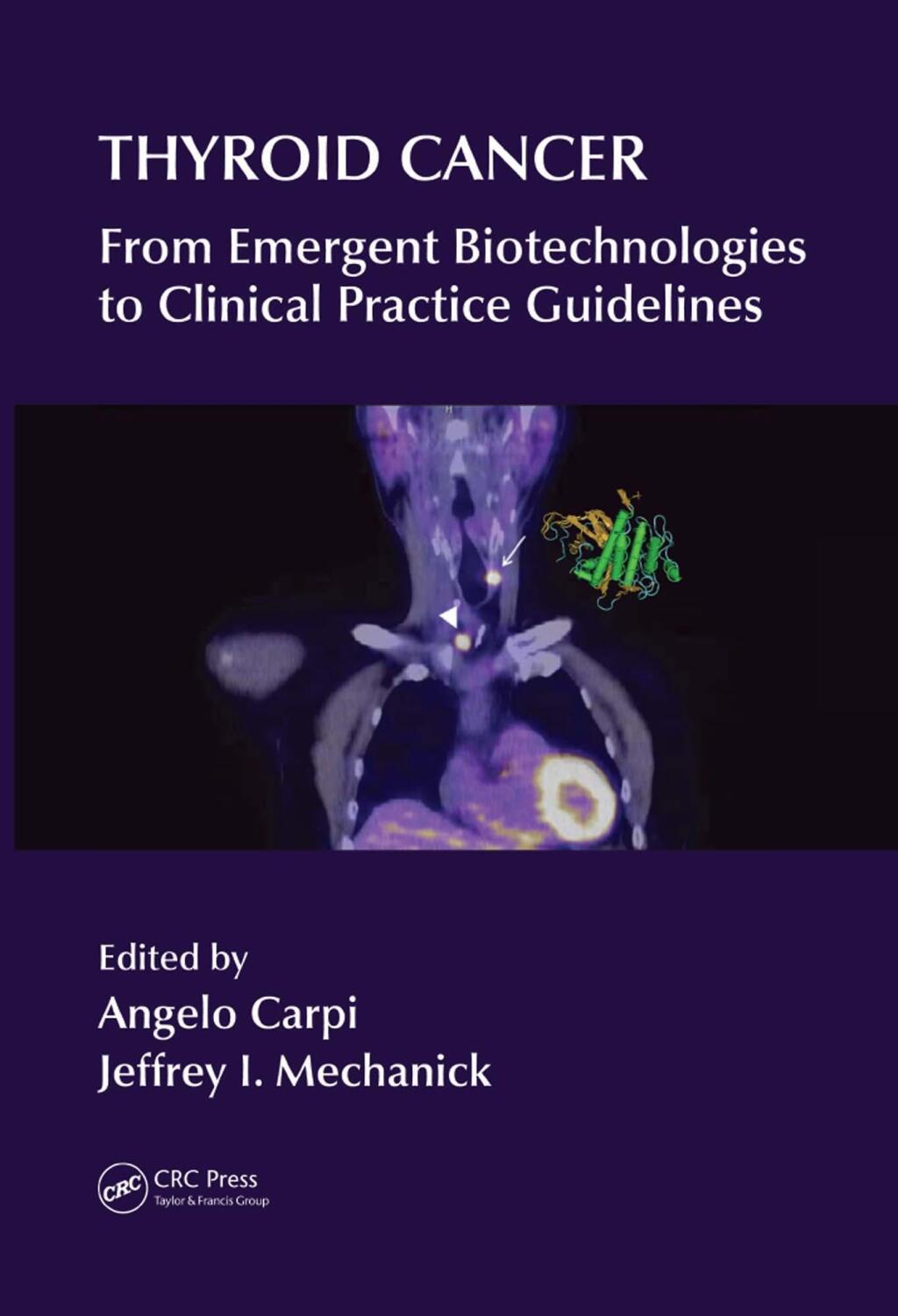 Thyroid Cancer From Emergent Biotechnologies to Clinical Practice Guidelines 1st Edition