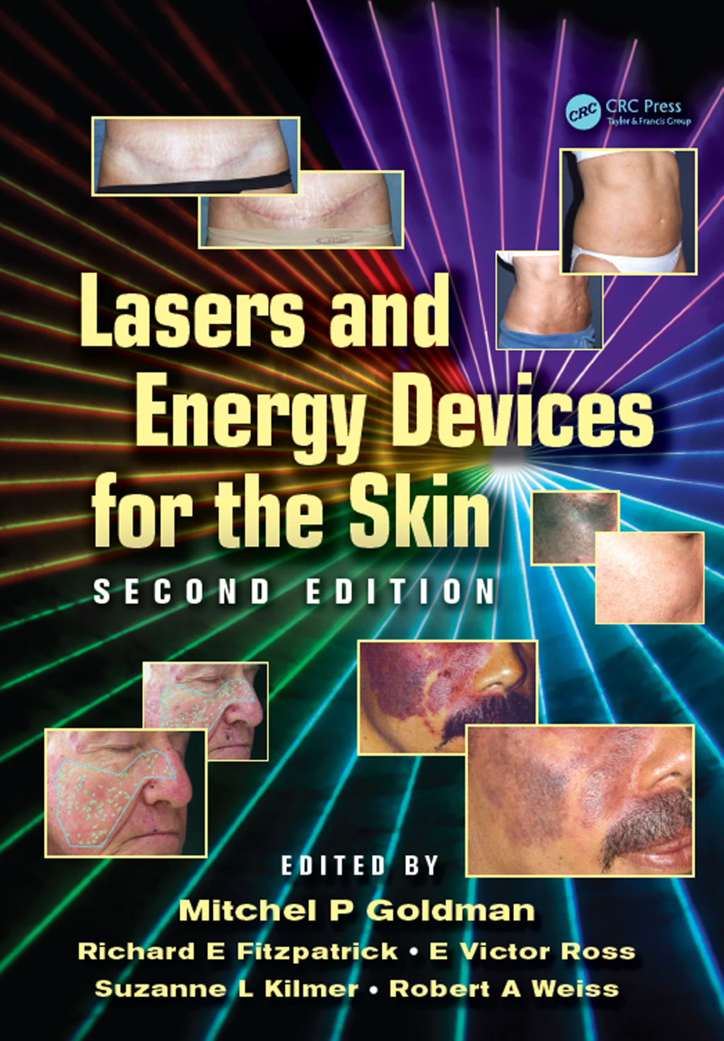 Lasers and Energy Devices for the Skin 2nd Edition