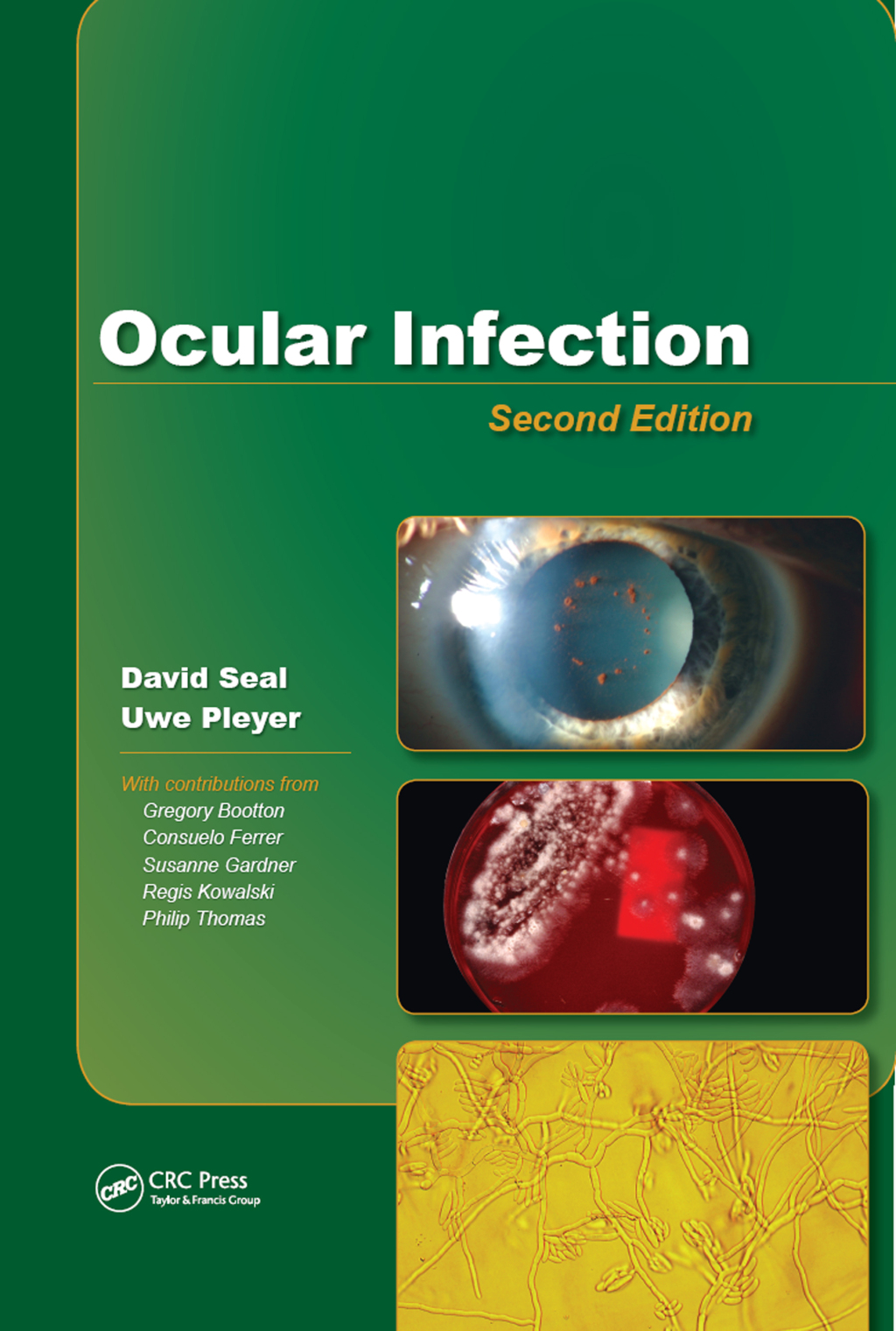 Ocular Infection Investigation and Treatment in Practice 2nd Edition