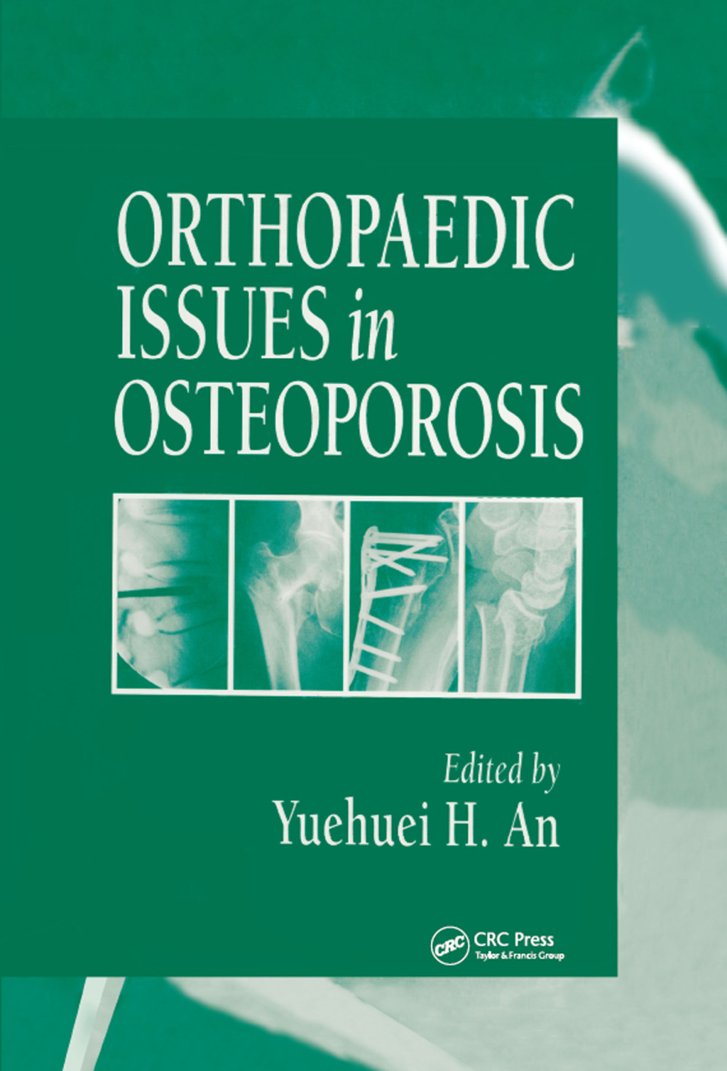 Orthopaedic Issues in Osteoporosis 1st Edition