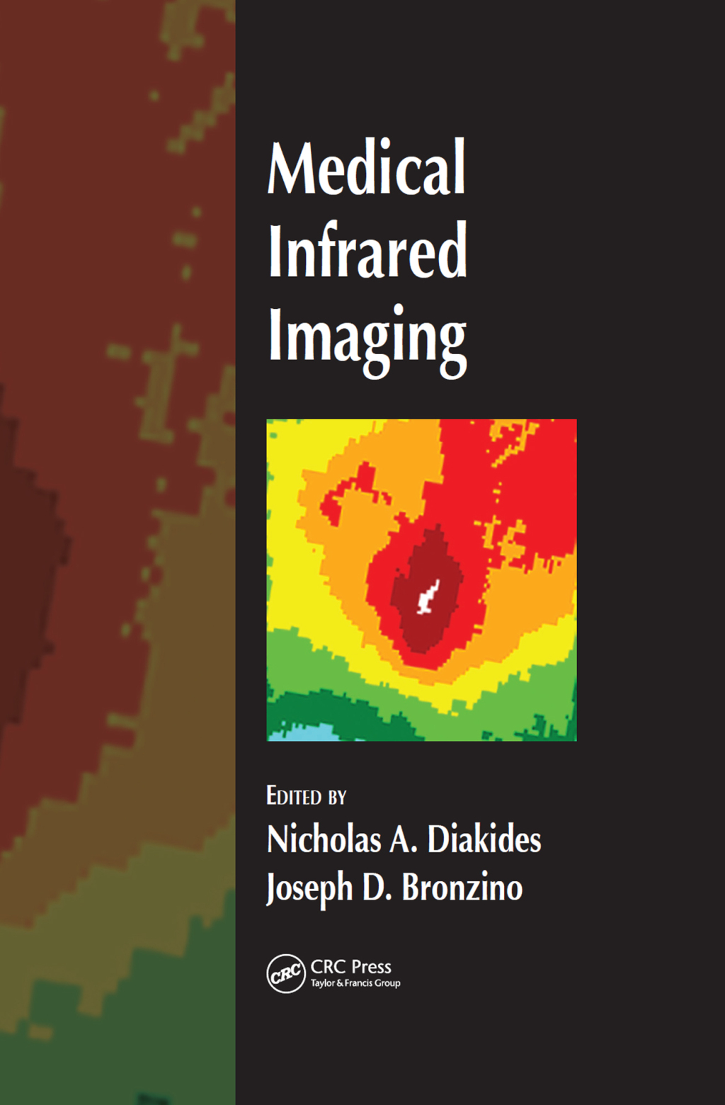 Medical Infrared Imaging 1st Edition