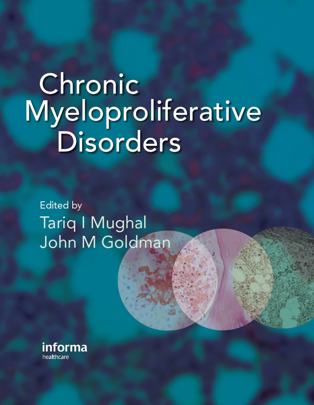 Chronic Myeloproliferative Disorders 1st Edition