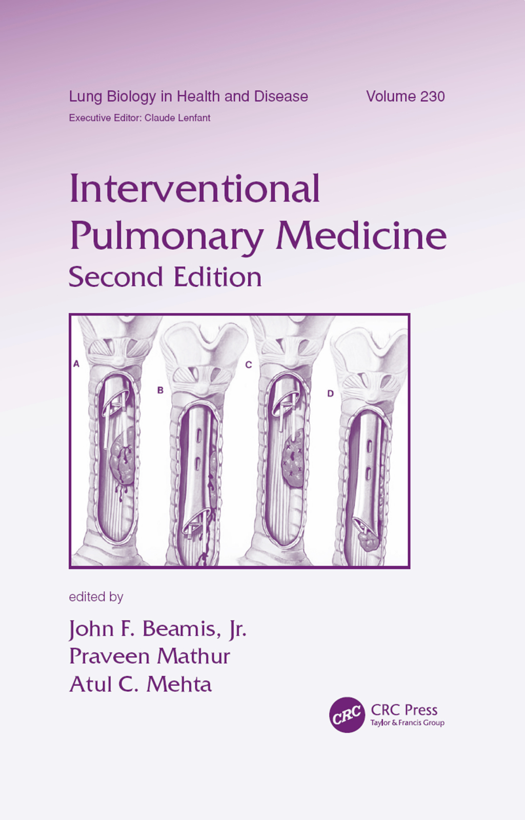 Interventional Pulmonary Medicine 2nd Edition