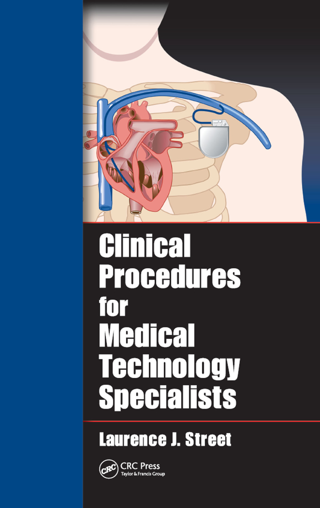 Clinical Procedures for Medical Technology Specialists 1st Edition