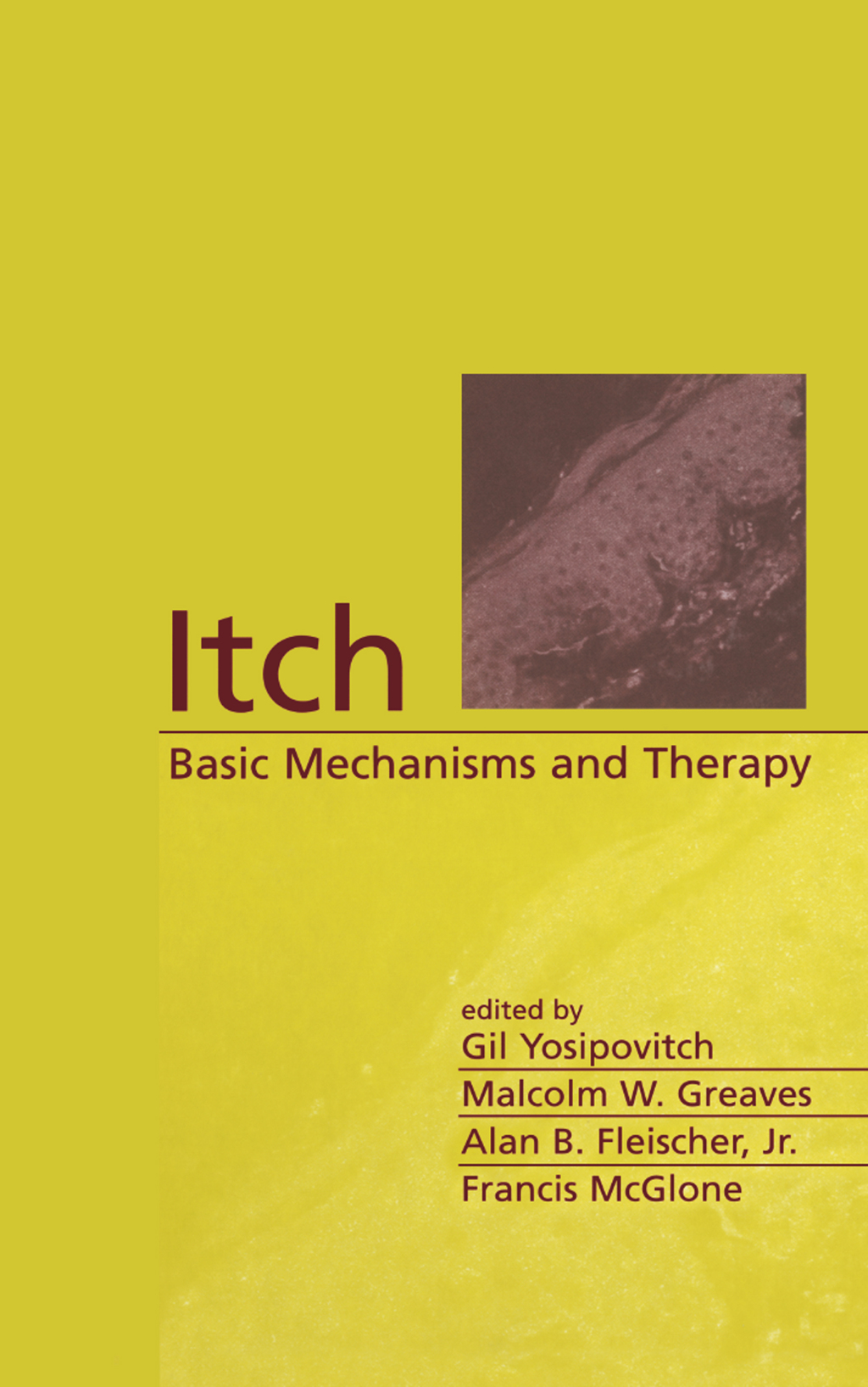Itch Basic Mechanisms and Therapy 1st Edition
