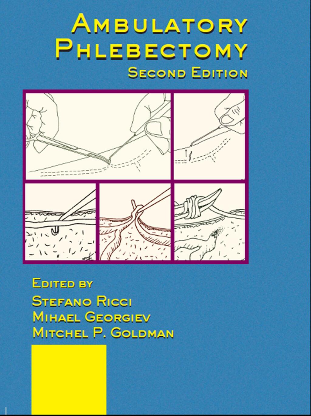 Ambulatory Phlebectomy 2nd Edition