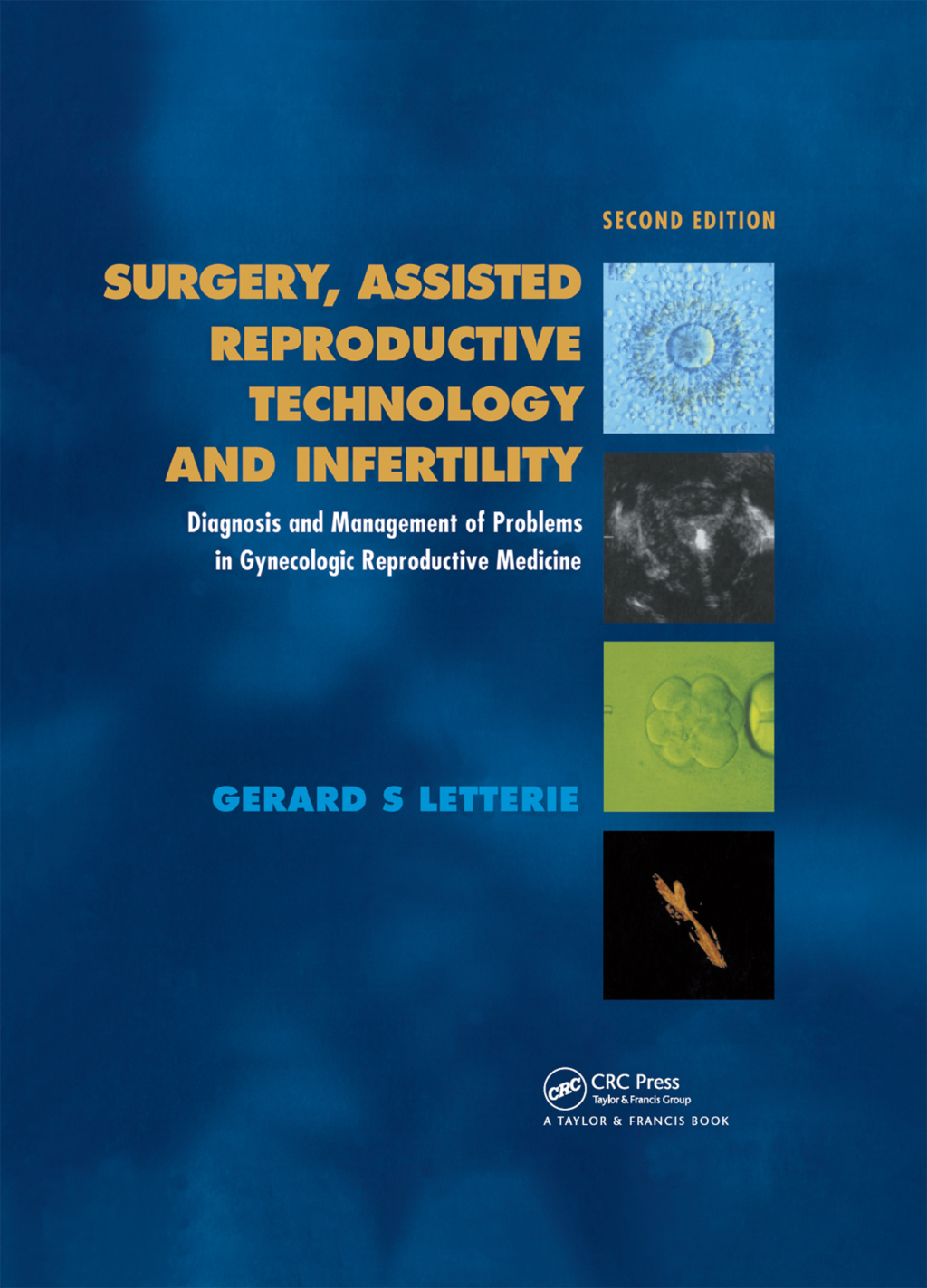 Surgery, Assisted Reproductive Technology and Infertility Diagnosis and Management of Problems in Gynecologic Reproductive Medicine 2nd Edition