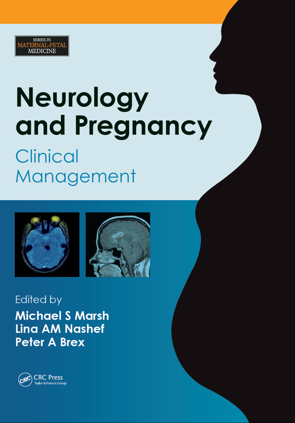 Neurology and Pregnancy Clinical Management 1st Edition