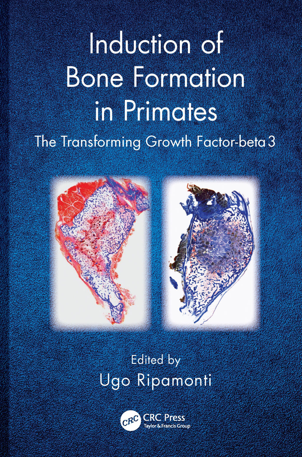 Induction of Bone Formation in Primates The Transforming Growth Factor-beta 3 1st Edition