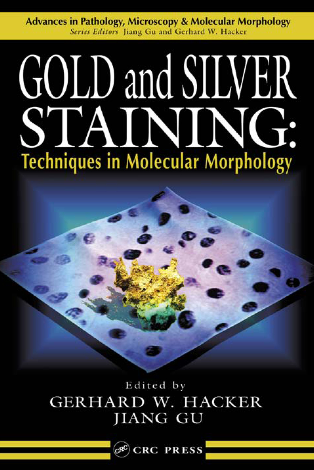 Gold and Silver Staining Techniques in Molecular Morphology 1st Edition