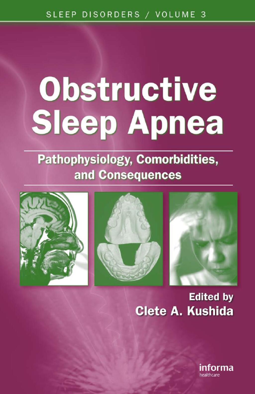 Obstructive Sleep Apnea: Pathophysiology, Comorbidities and Consequences Pathophysiology, Comorbidities, and Consequences 1st Edition