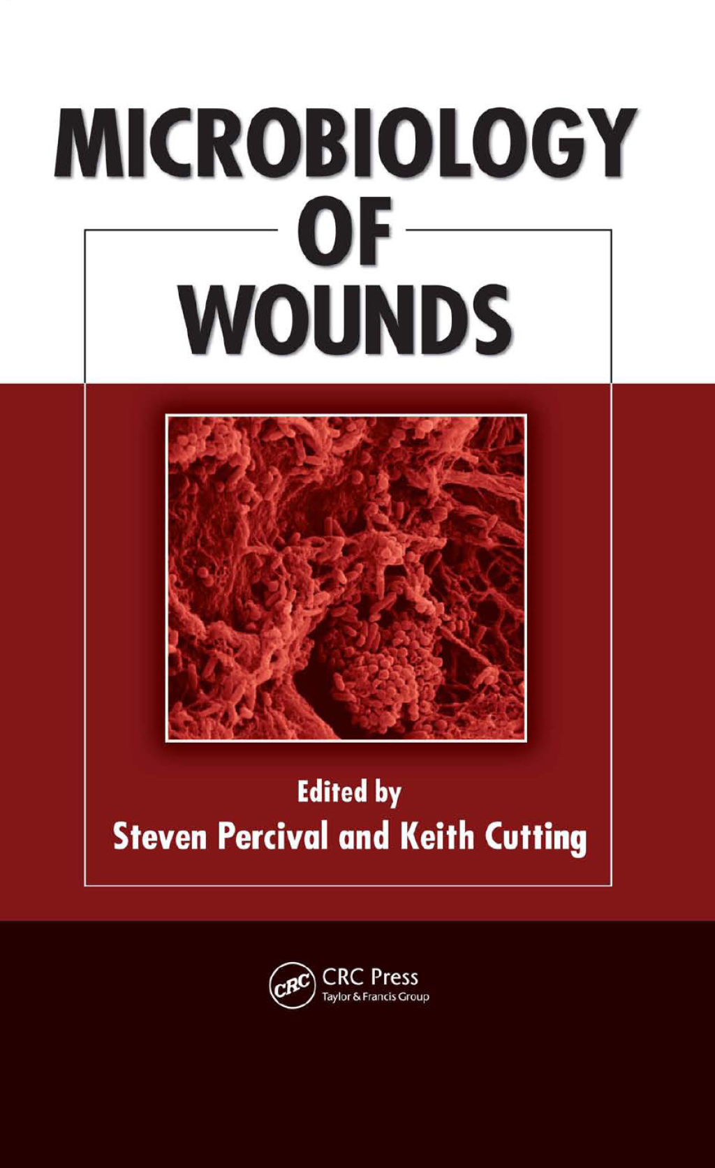 Microbiology of Wounds 1st Edition
