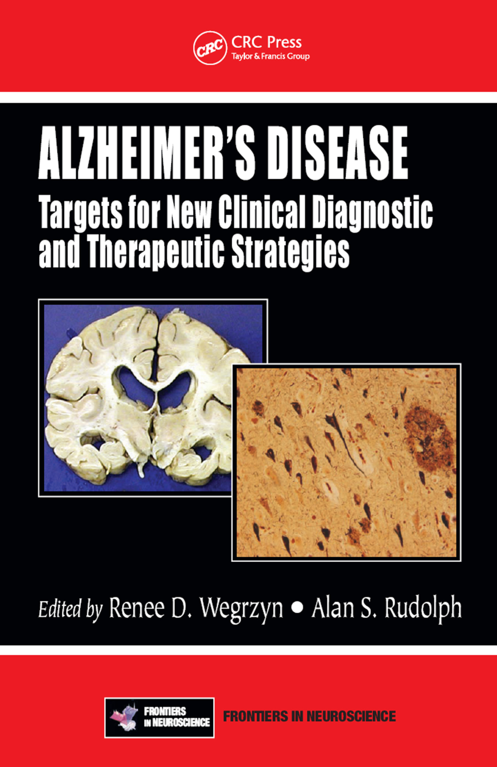 Alzheimer's Disease Targets for New Clinical Diagnostic and Therapeutic Strategies 1st Edition