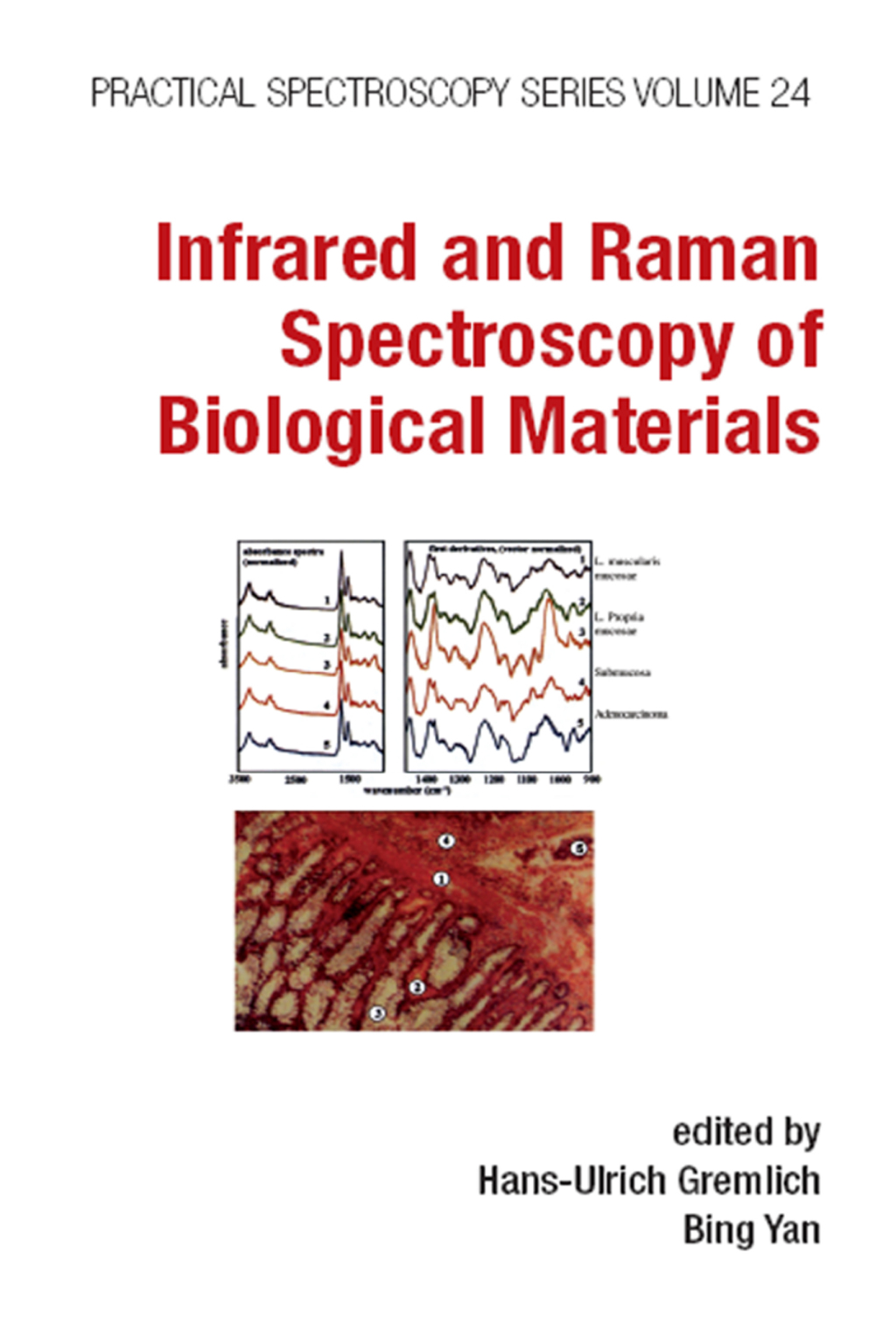 Infrared and Raman Spectroscopy of Biological Materials 1st Edition