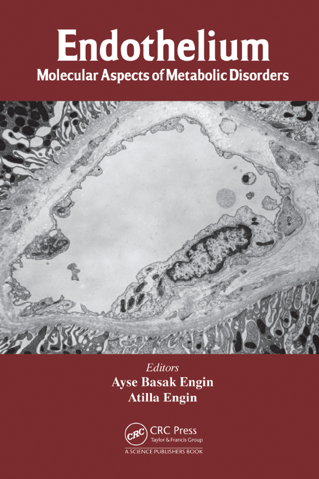 Endothelium Molecular Aspects of Metabolic Disorders 1st Edition