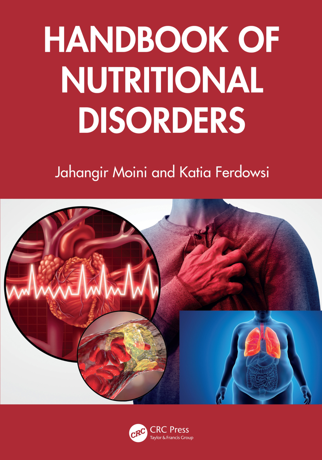 Handbook of Nutritional Disorders 1st Edition