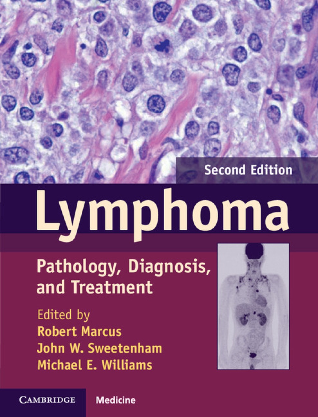 Lymphoma Pathology, Diagnosis, and Treatment 2nd Edition