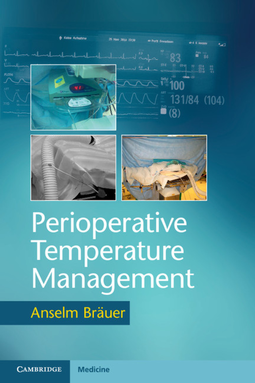 Perioperative Temperature Management 