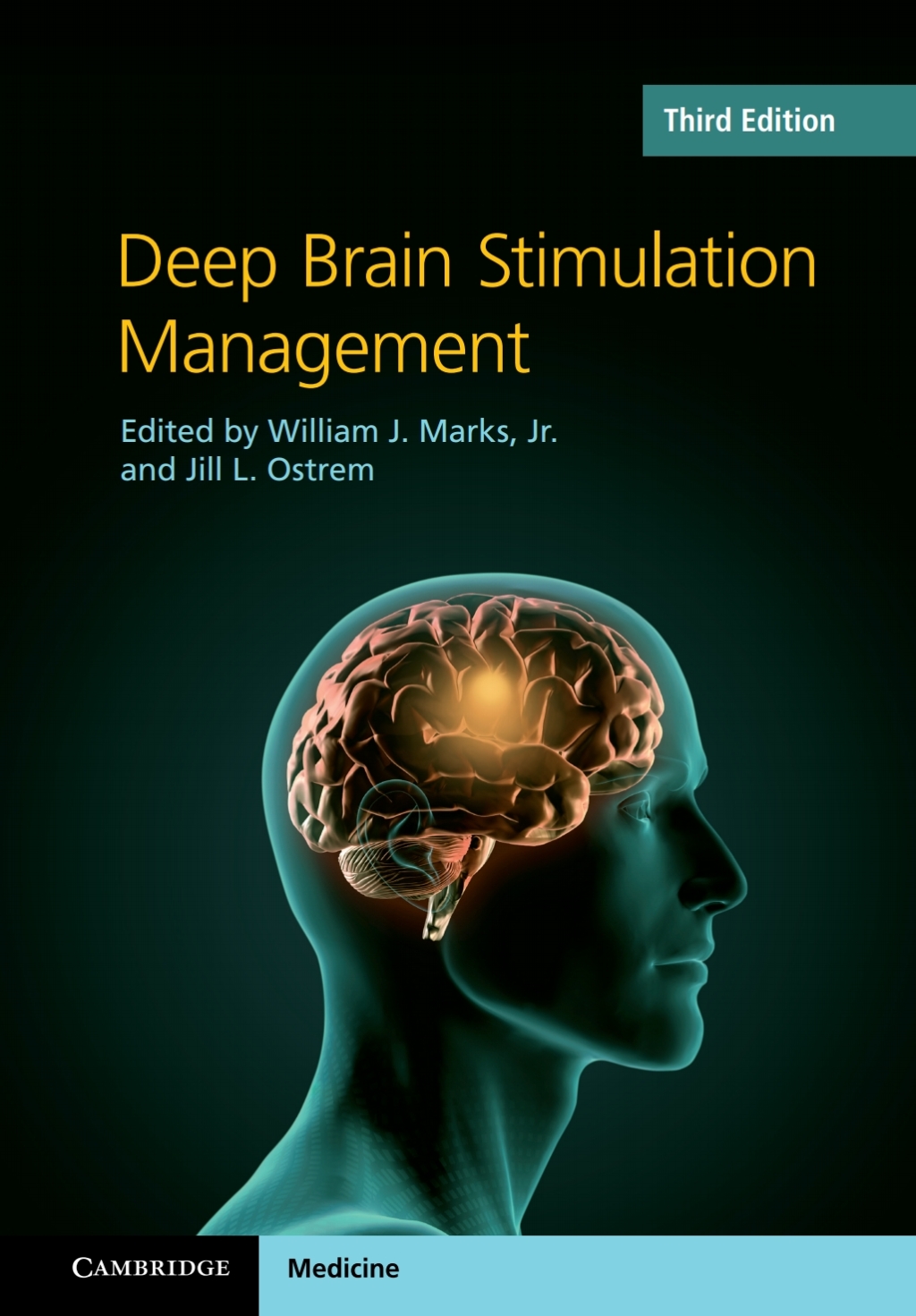 Deep Brain Stimulation Management 3rd Edition