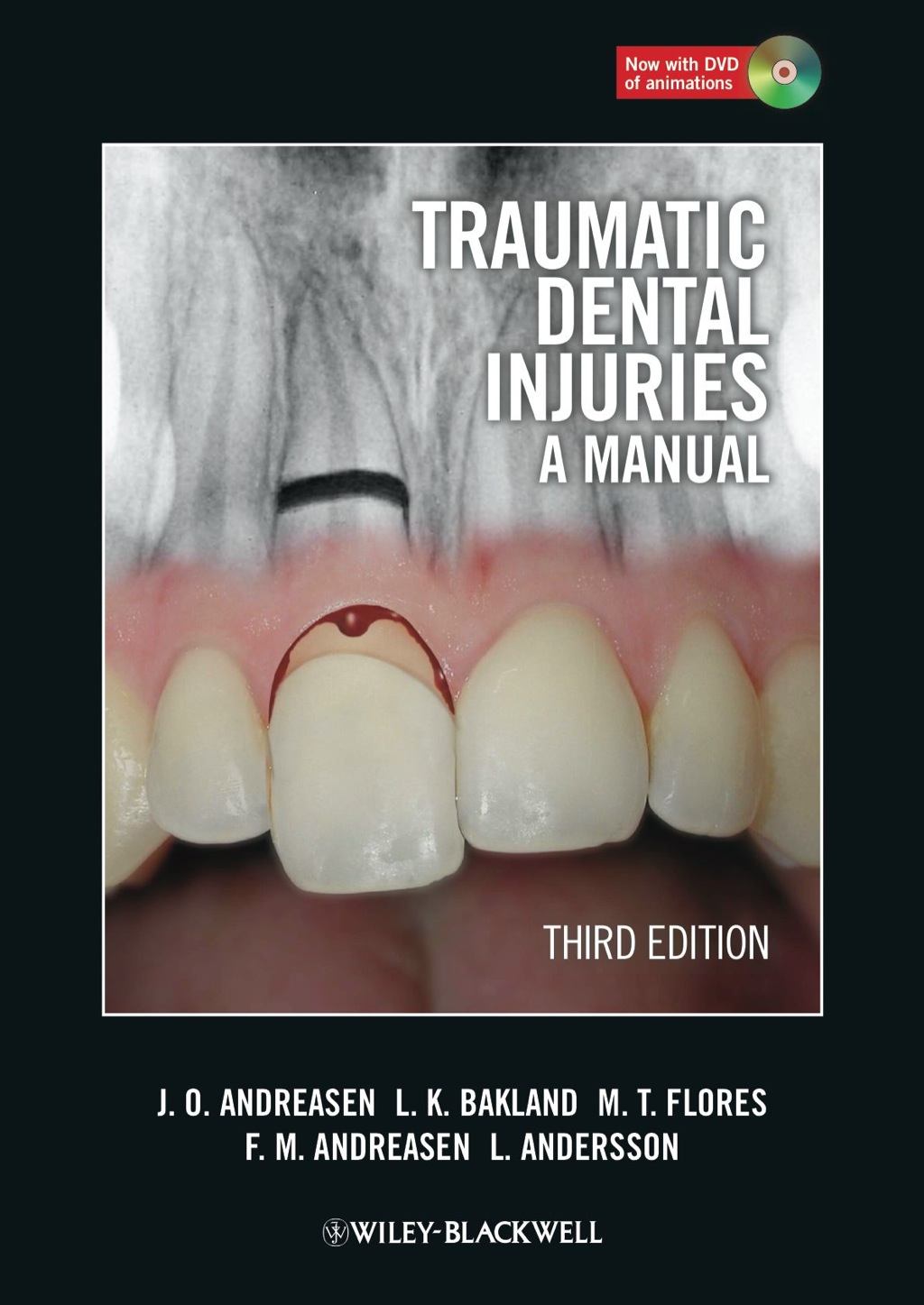Traumatic Dental Injuries: A Manual 3rd Edition