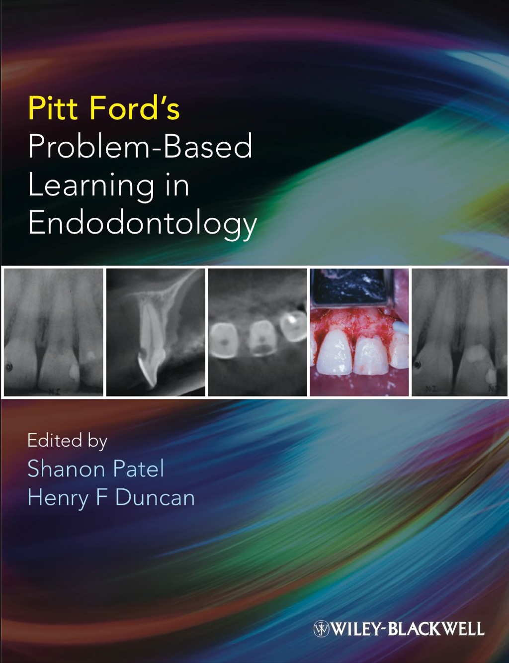 Pitt Ford's Problem-Based Learning in Endodontology 1st Edition