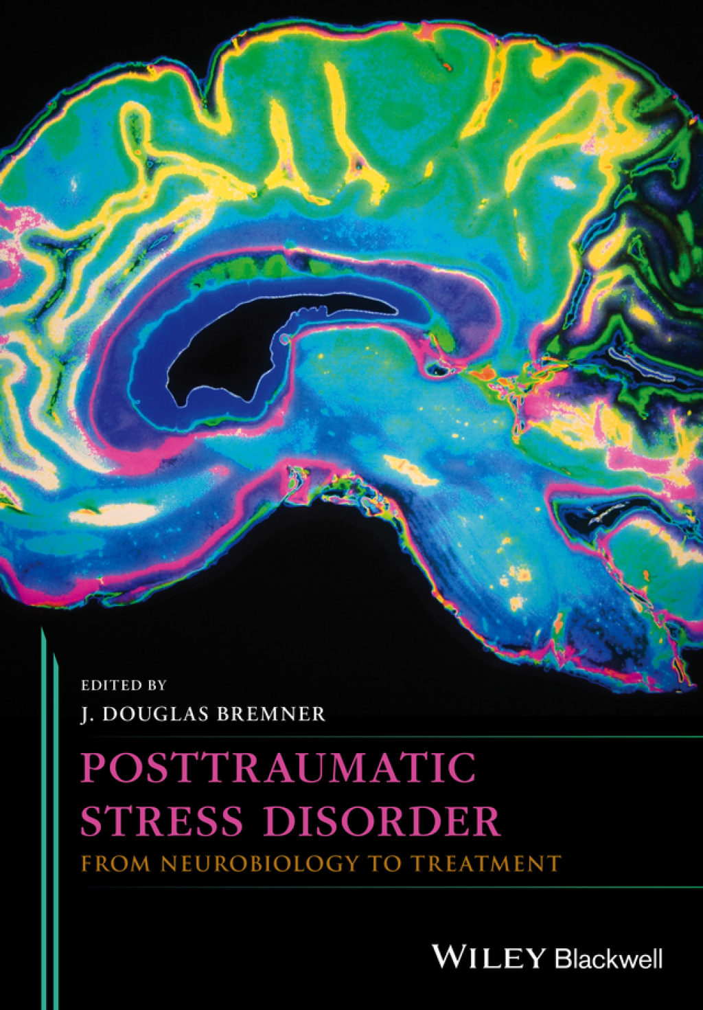 Posttraumatic Stress Disorder: From Neurobiology to Treatment From Neurobiology to Treatment 1st Edition