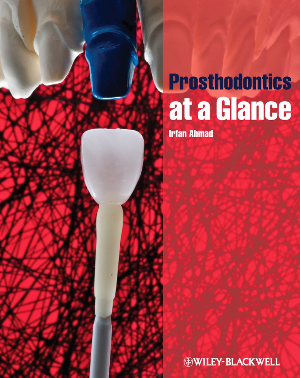 Prosthodontics at a Glance 1st Edition