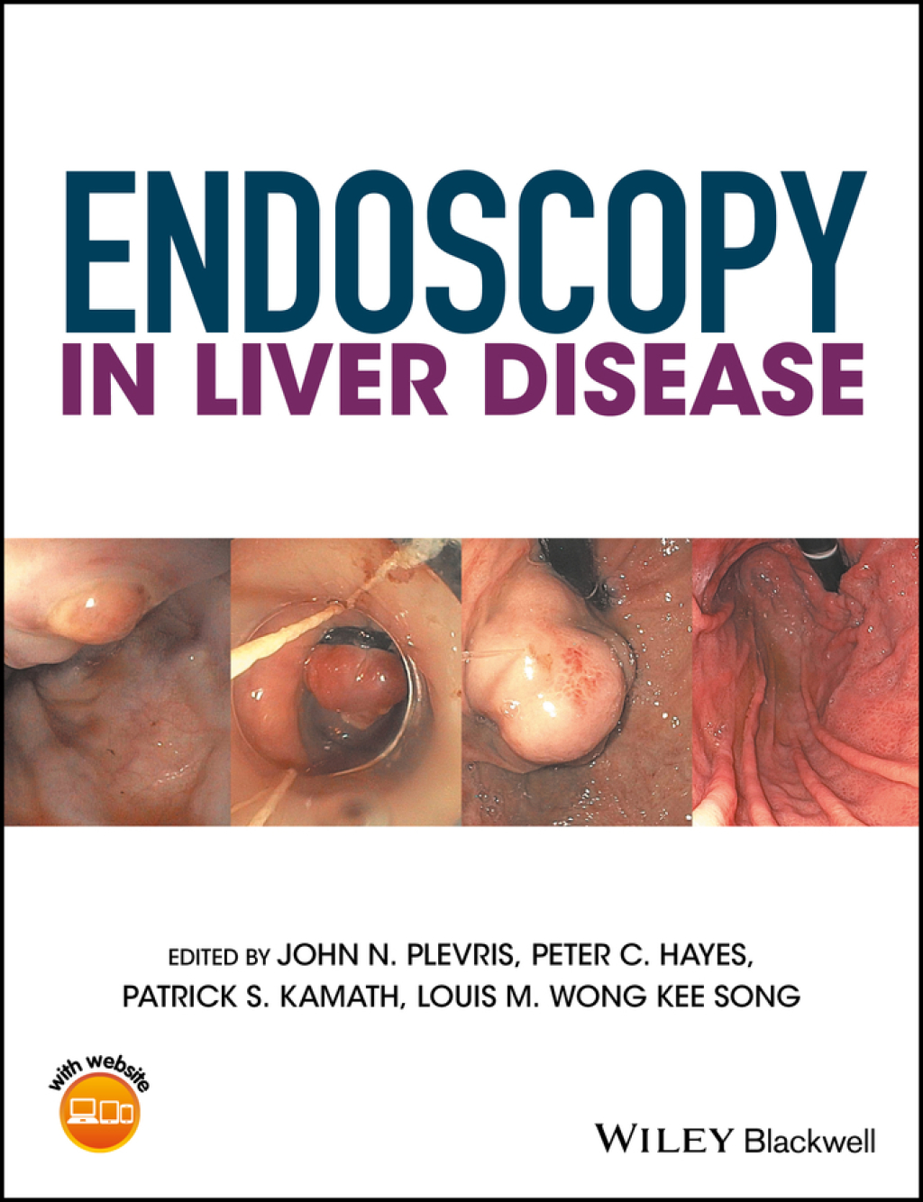 Endoscopy in Liver Disease 1st Edition