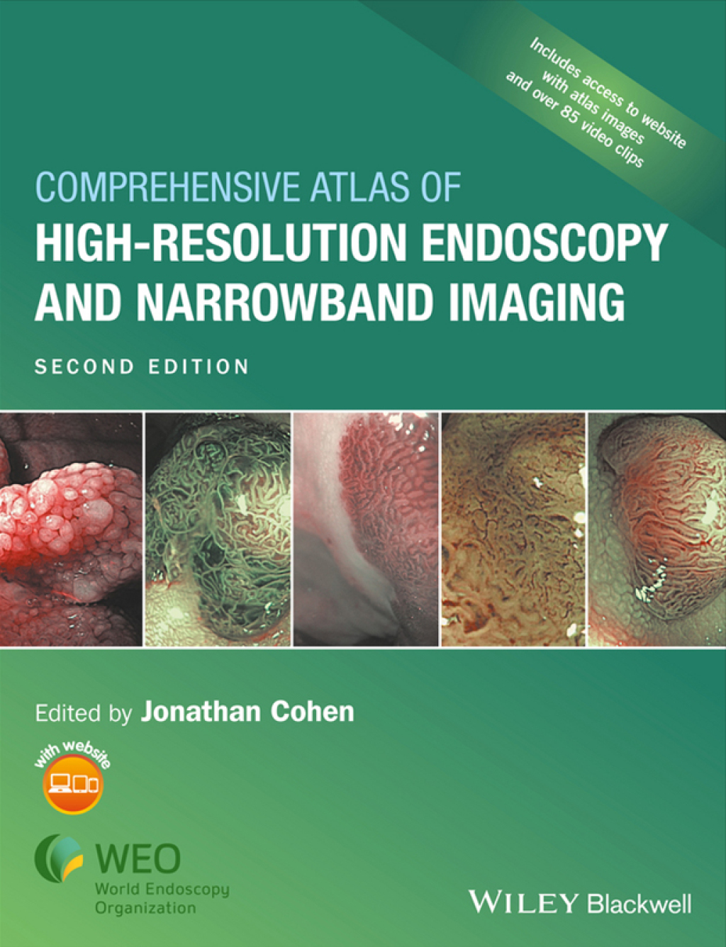 Comprehensive Atlas of High-Resolution Endoscopy and Narrowband Imaging 2nd Edition