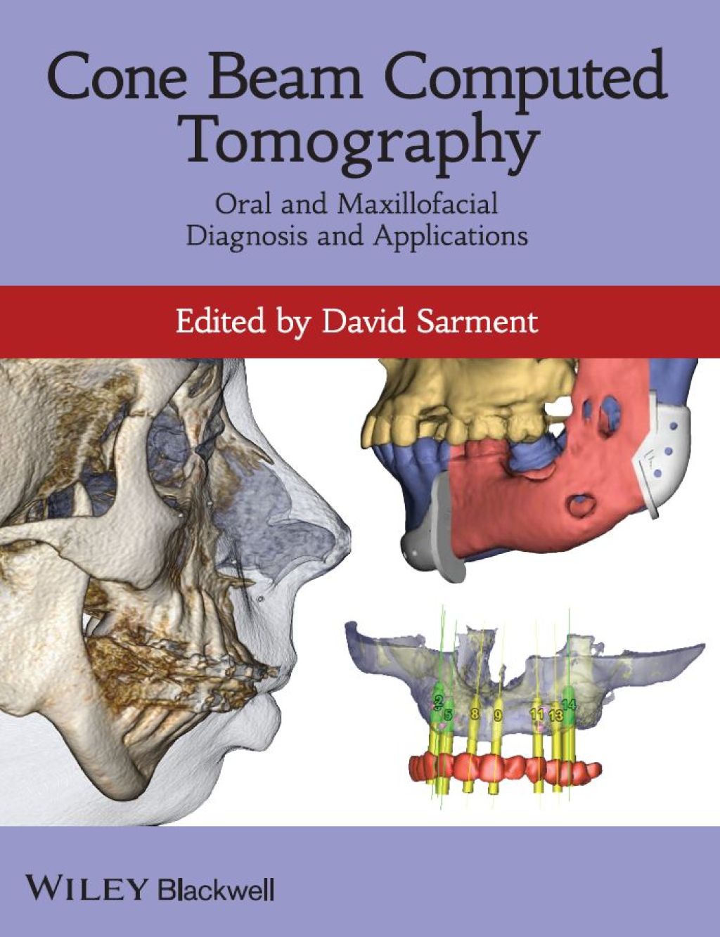 Cone Beam Computed Tomography Oral and Maxillofacial Diagnosis and Applications 1st Edition