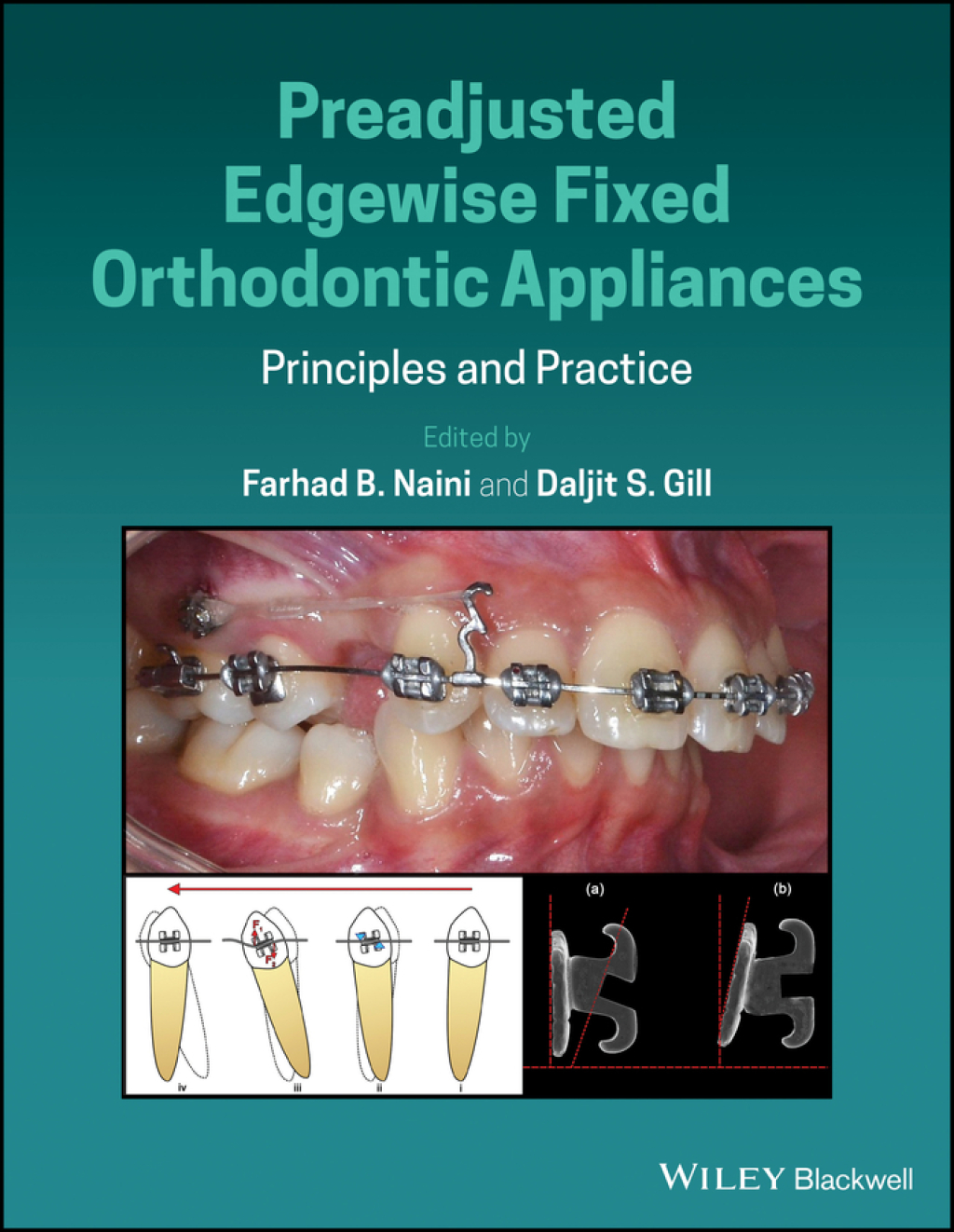 Preadjusted Edgewise Fixed Orthodontic Appliances Principles and Practice 1st Edition