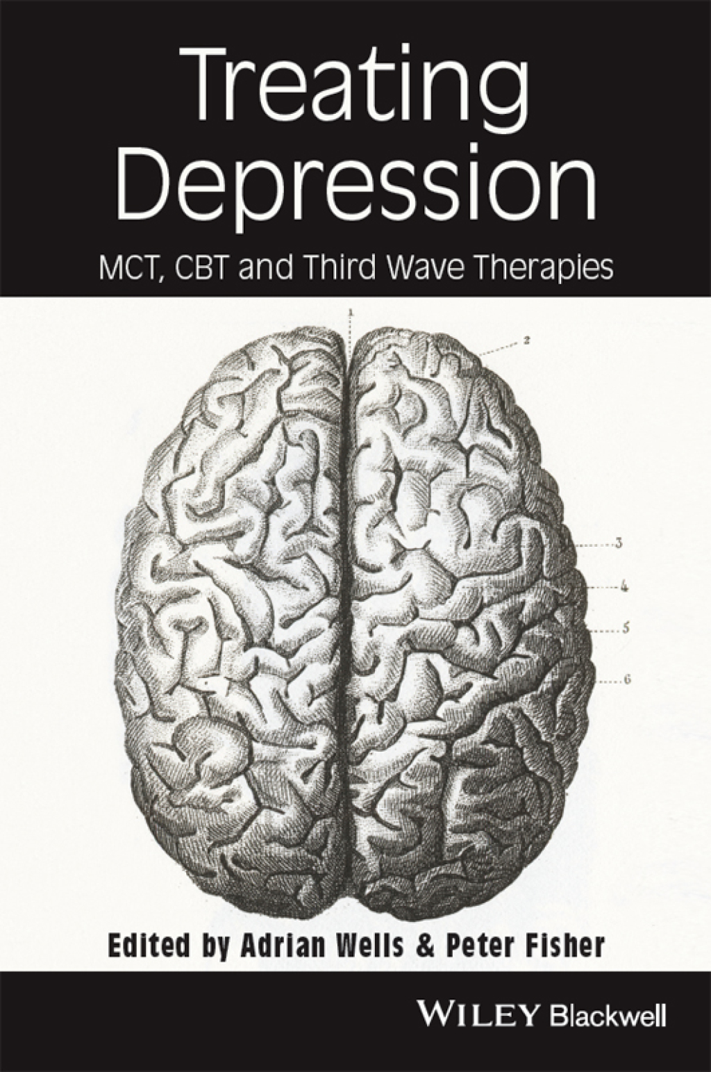 Treating Depression: MCT, CBT, and Third Wave Therapies MCT, CBT, and Third Wave Therapies 1st Edition