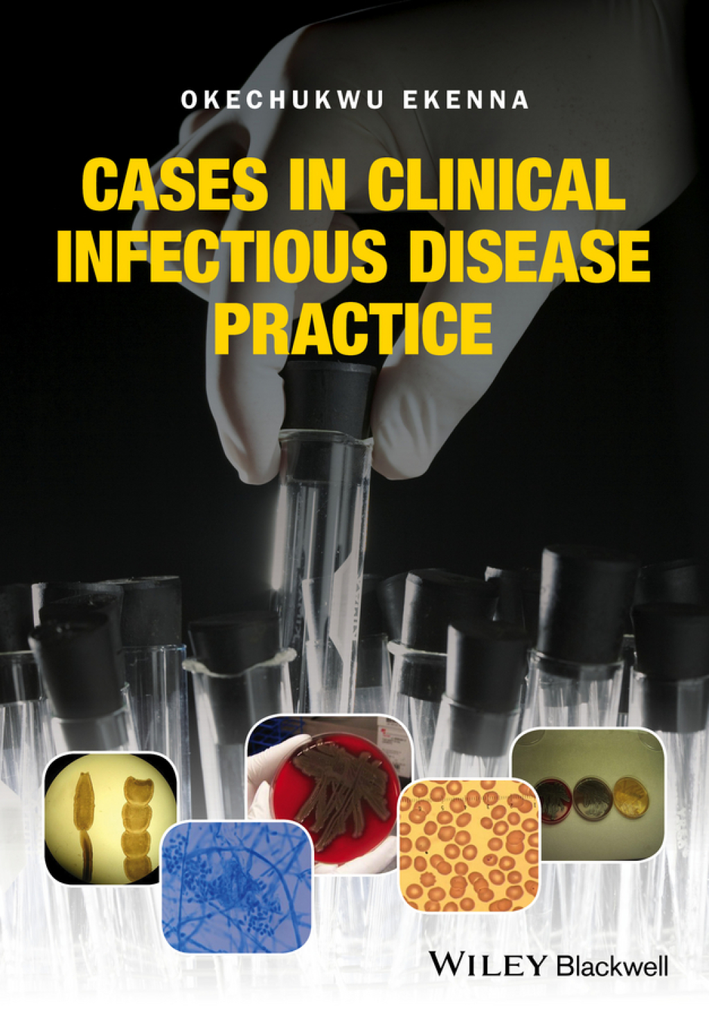 Cases in Clinical Infectious Disease Practice 1st Edition
