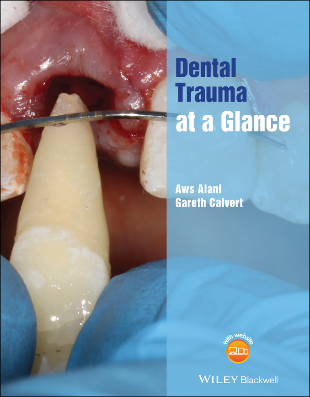 Dental Trauma at a Glance 1st Edition