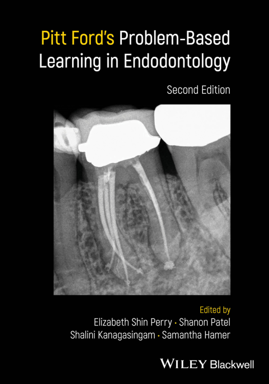 Pitt Ford's Problem-Based Learning in Endodontology 2nd Edition