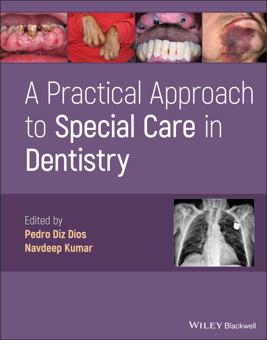 A Practical Approach to Special Care in Dentistry 1st Edition