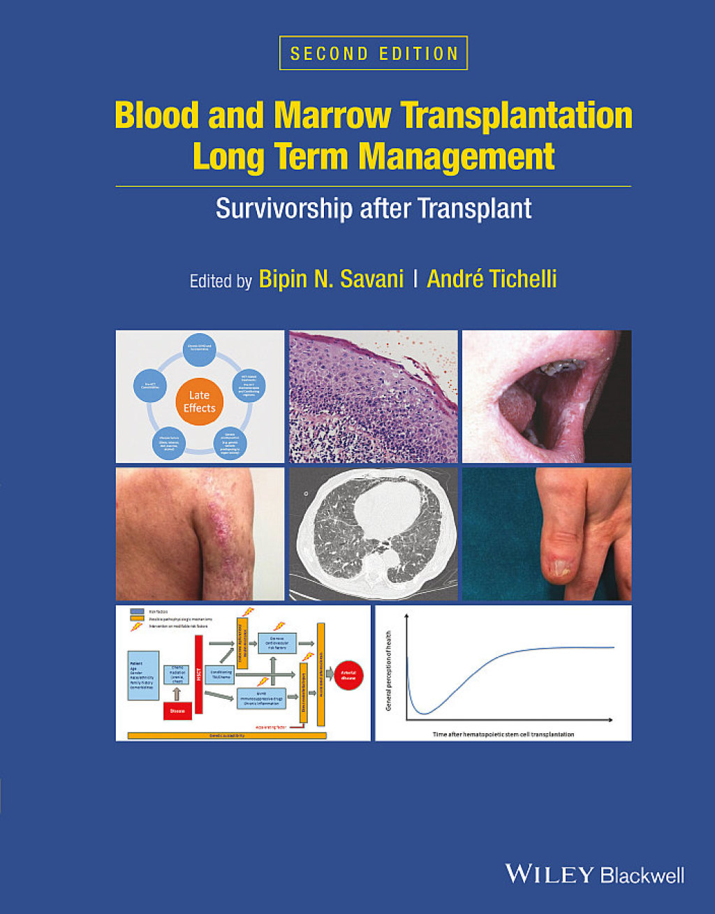 Blood and Marrow Transplantation Long Term Management Survivorship after Transplant 2nd Edition
