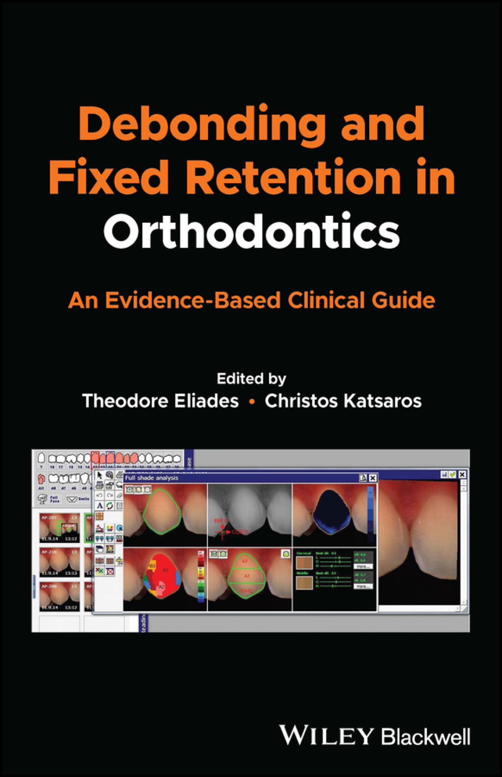Debonding and Fixed Retention in Orthodontics An Evidence-Based Clinical Guide 1st Edition